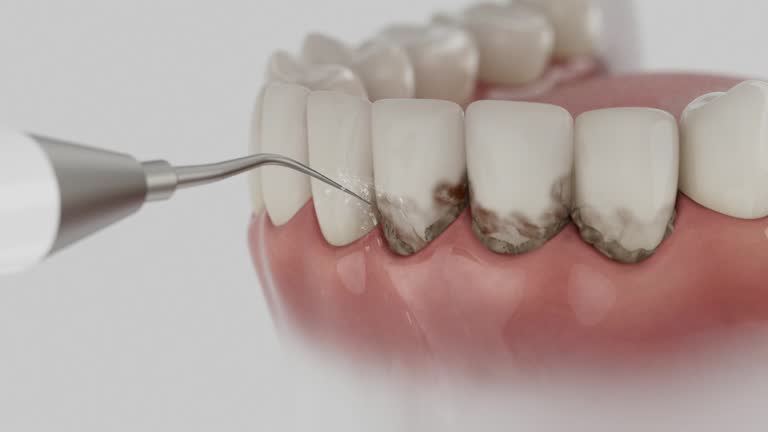 Trusted Tooth Extraction service in Reidland, KY - Dentist Open Now
